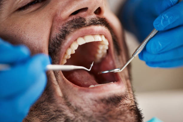 Best Mobile Emergency Dentist in Pecatonica, IL